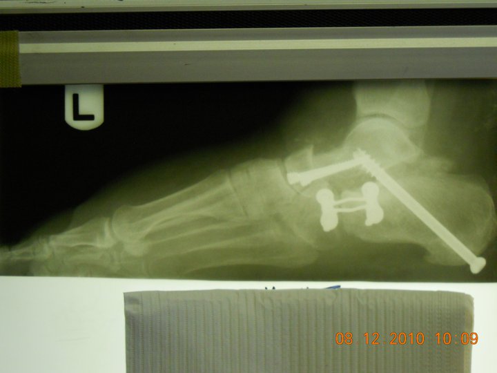 Texas Foot   Ankle Institute