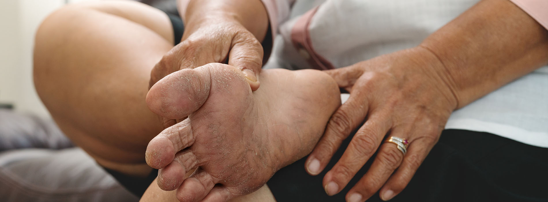 Texas Foot   Ankle Institute | Achilles Tendon Surgery, Fractures of the Foot   Ankle and Drop Foot Braces