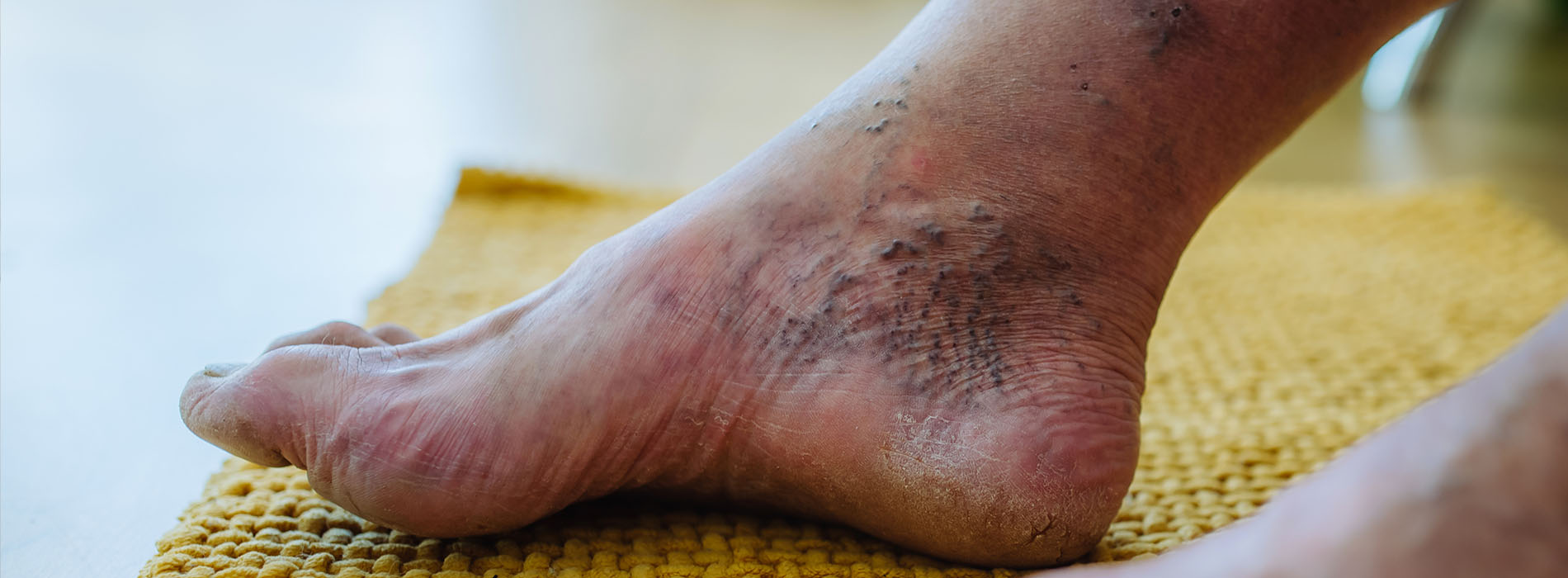 Texas Foot   Ankle Institute | Pediatric Foot Problems, Ankle Sprains and Foot   Ankle Deformities