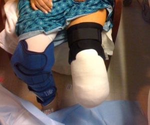 Texas Foot Ankle Institute